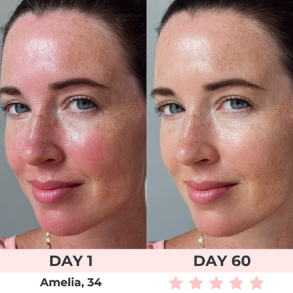 RadianceGuard™ - LED Face Mask